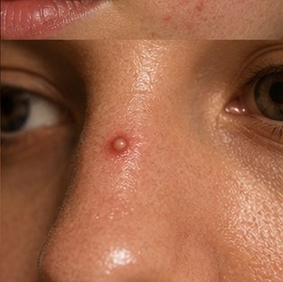 Is Your Morning Coffee Ruining Your Skin? The Science of Caffeine and Complexions