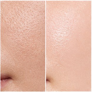Is Your Skin Barrier Crying for Help? Signs It’s Time for a Reset