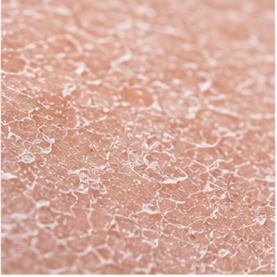Is Your Skin Barrier Crying for Help? Signs It’s Time for a Reset