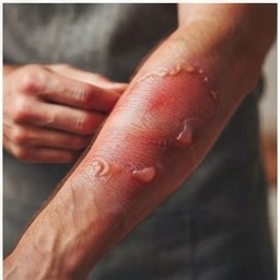 Pressure Cooker Explosion Risk: The One Thing You Must Never Do After Cooking